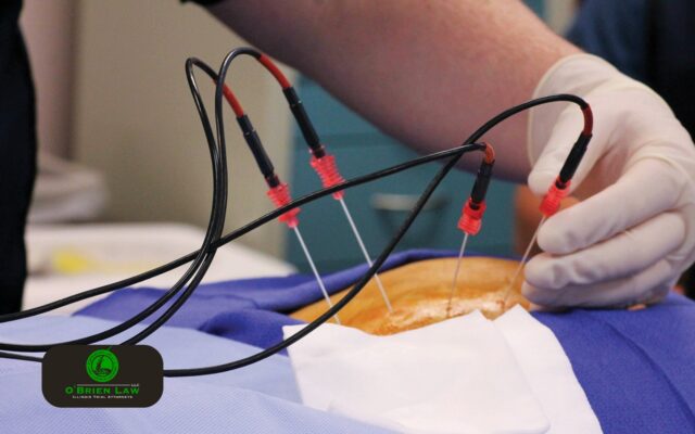 Radiofrequency Ablation for Chronic Neck and Back Pain After a Car Accident